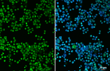 Anti-PAX5 antibody [HL5694] used in Immunocytochemistry/ Immunofluorescence (ICC/IF). GTX646525